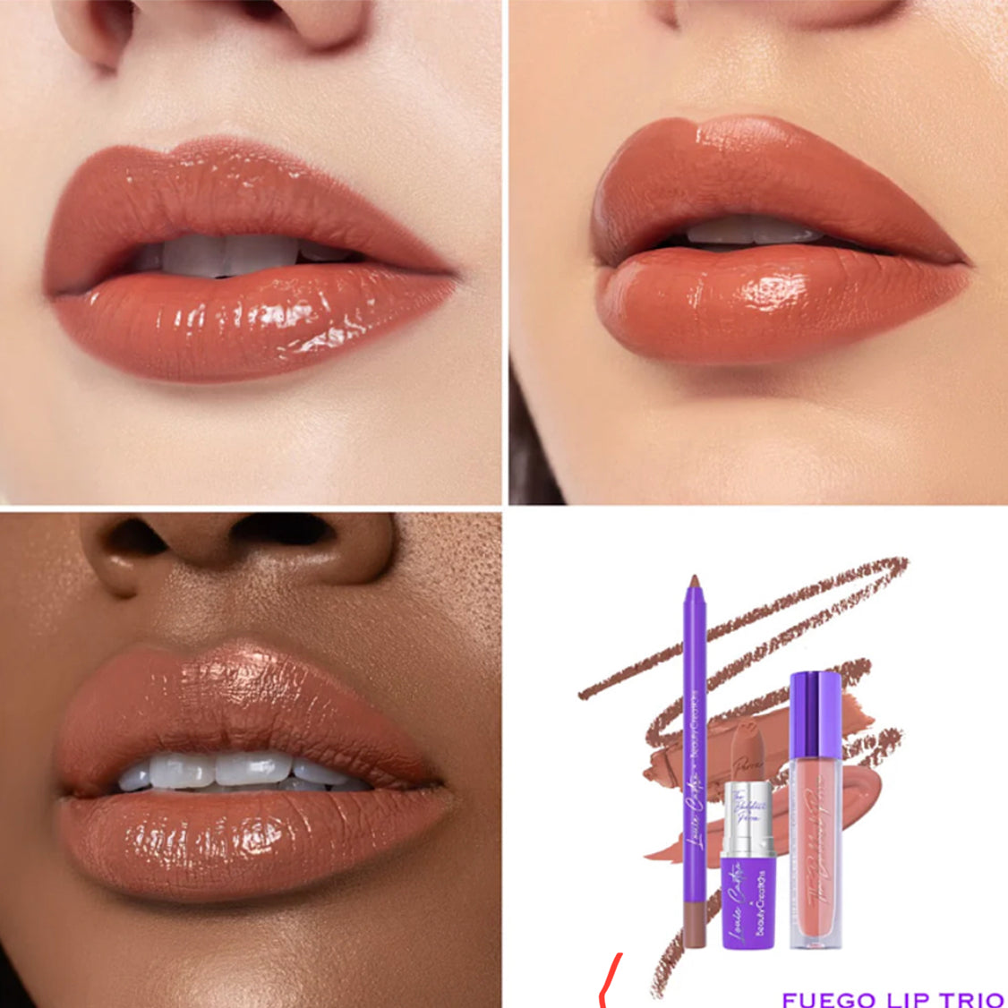 Fuego Lip Kit